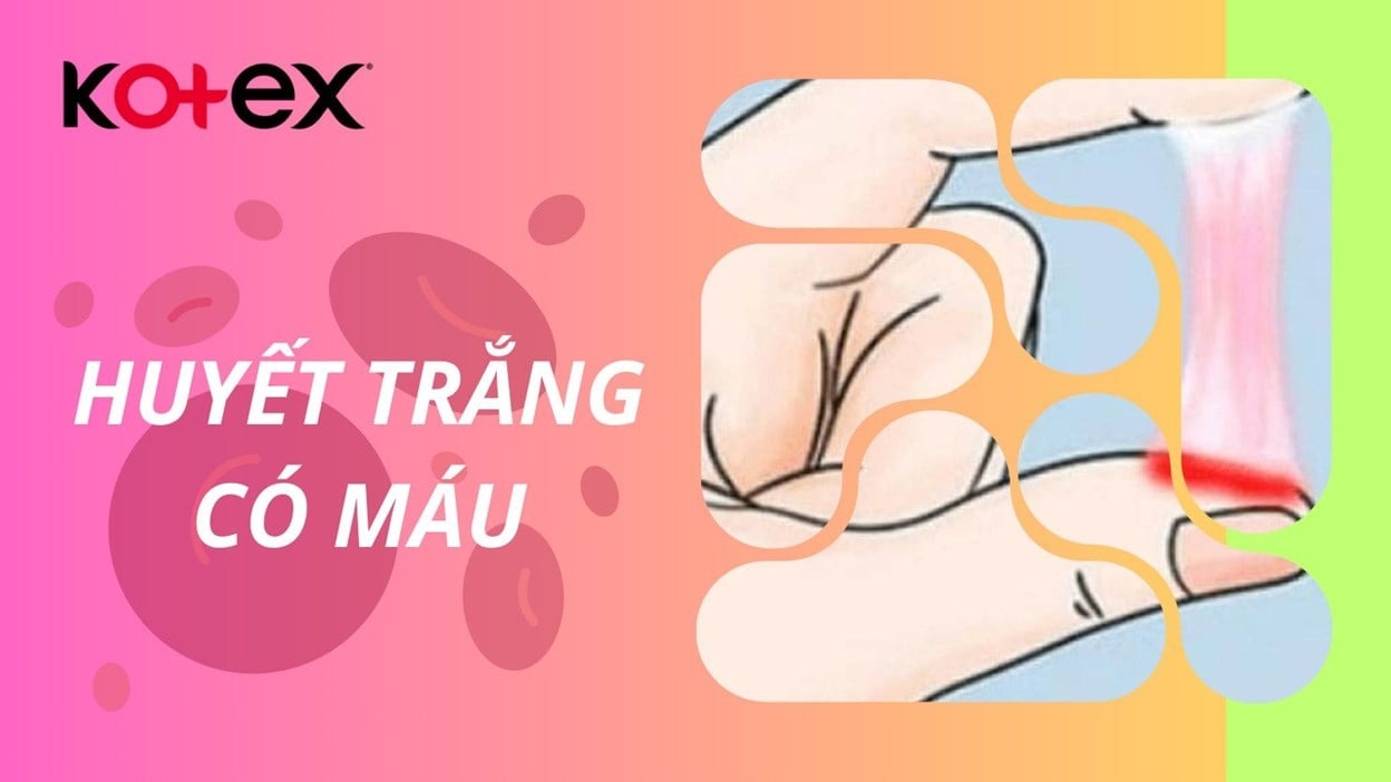 Terbukti! 7 Contoh Soal Tema 5 Kelas 2 Subtema 1 yang Bikin Anak Cepat Paham Sebelum Ujian